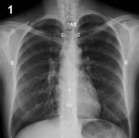 Tecnología moderna; radiografía