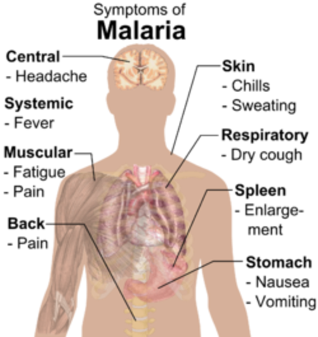 Ancient Rome - Disease