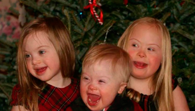 Presentacion de la Causa del Síndrome de Down