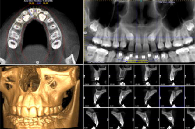 Lanzamiento de SIemens MPR/MPD      ThootPix     Allegro Workstation    Imagemaster, Todos estos prototipos de TCHC