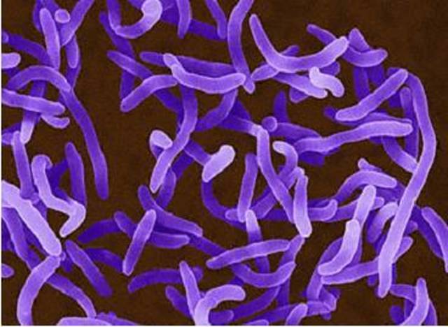 Koch: Descubrimiento Bacilo del cólera