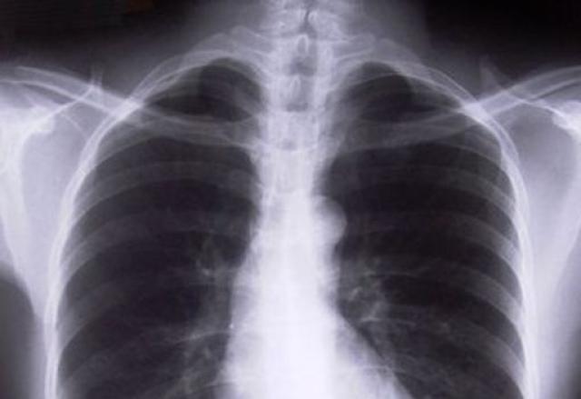 LA MÁQUINA DE RAYOS  X