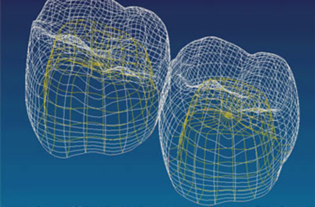 Mayor esplendor para la Odontología Computarizada