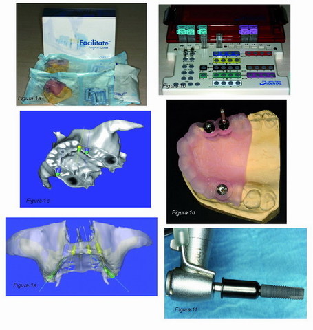 Comienzo de las aplicaciones guiadas y asistidas por ordenador