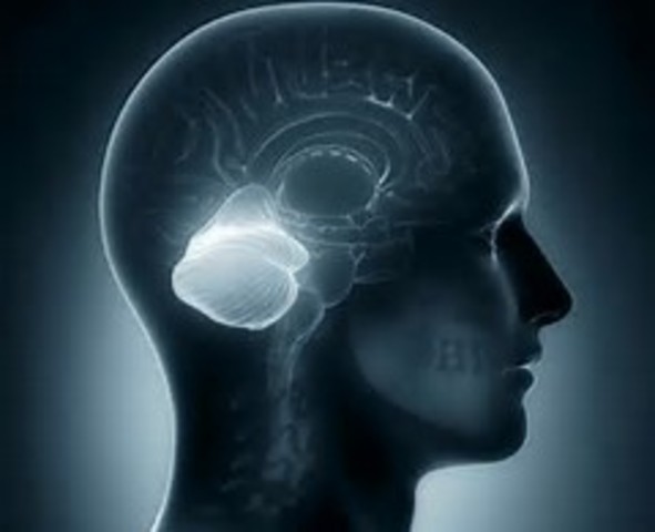 Etiology: Cerebellum