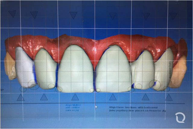 Sistema DCS-precident
