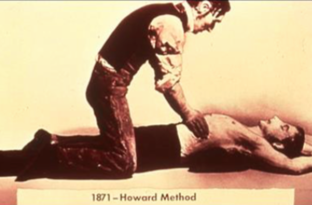 Método Howard. Compresión externa del tórax