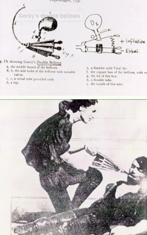 El uso de los fuelles en la RCP