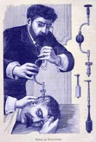 Modelos Demonológicos. Trepanaciones.