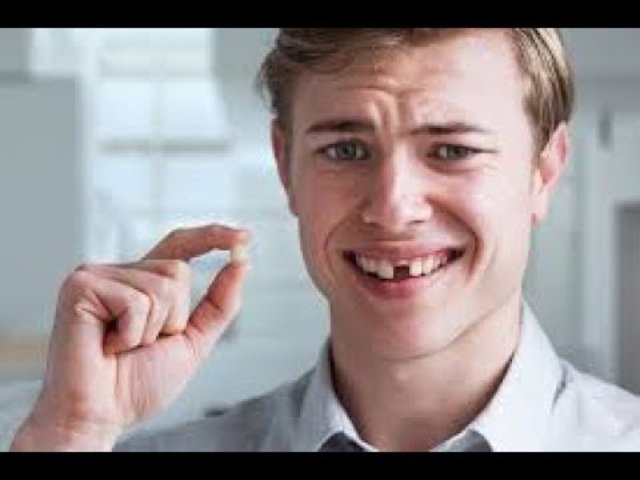 The first time I lost a tooth