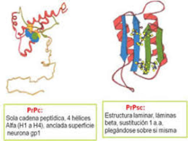 Encefalopatía espongiforme transmisible