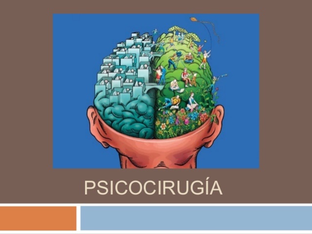 Psicocirugía