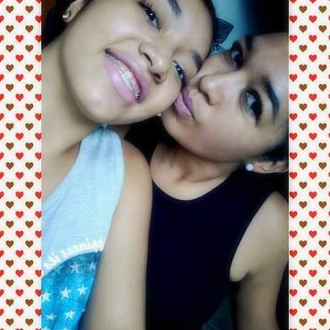 me pusieron los brackes