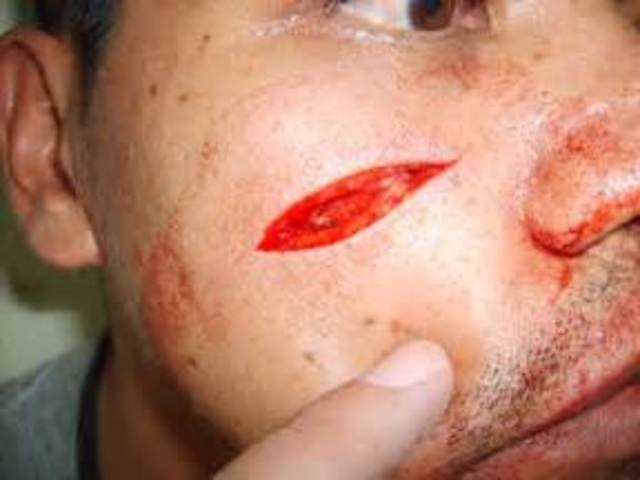 Todo tiene algo malo