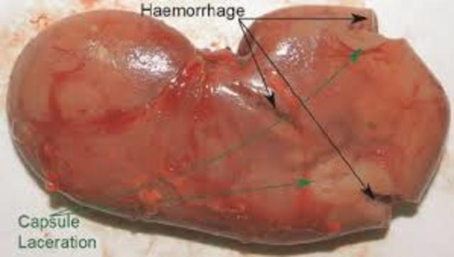 Upset Intestinal Alliance