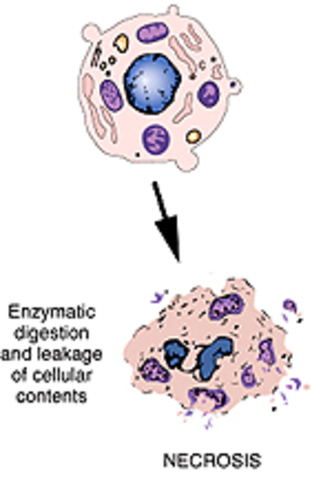 four minutes after death