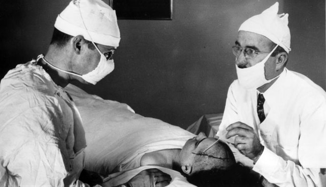 Lobectomias como tratamiento