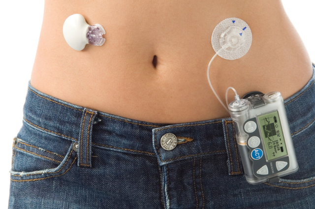 CGM - Ciągłe Monitorowanie Glikemii