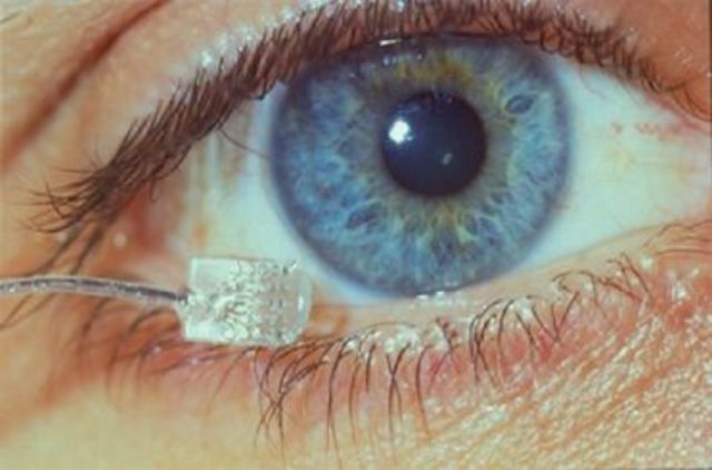 Los implantes de retina