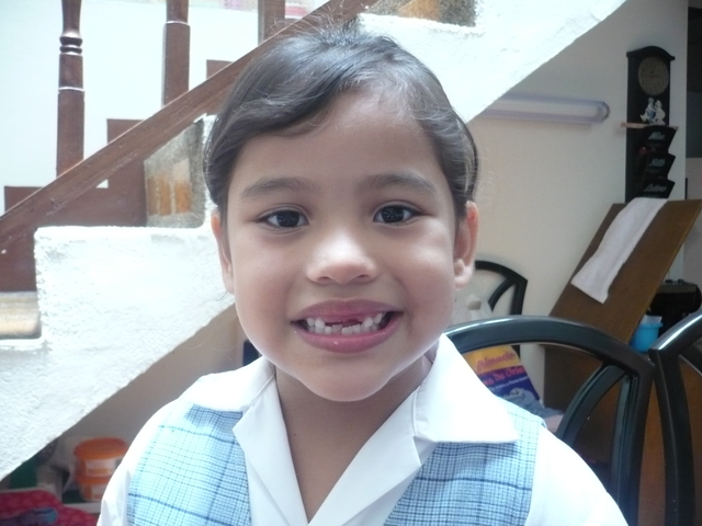 Caída de mis dientes