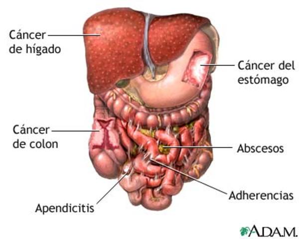 enfermedades del aparato digetivo