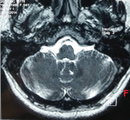 Transmisión de la ECJ