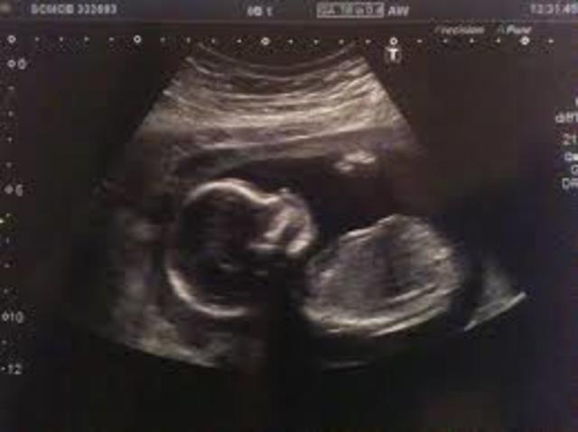 mi primera ecografia