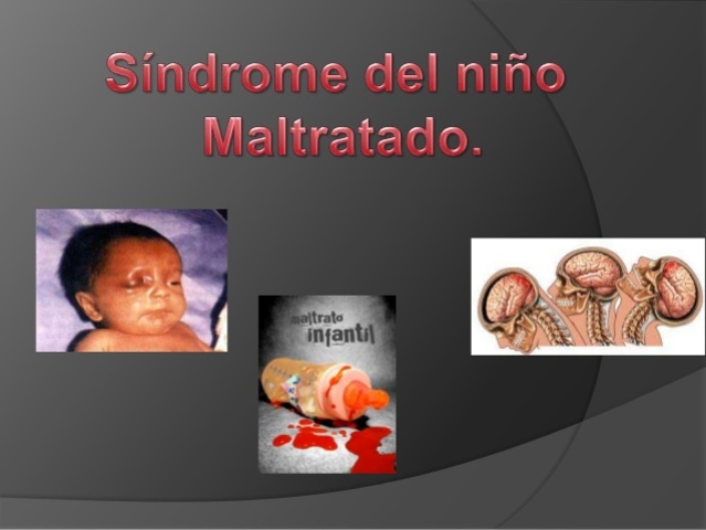 SINDROME DEL MLATRATO INFANTIL