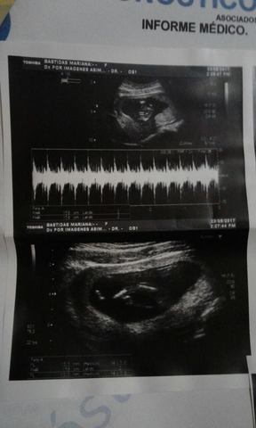 Enterarme que seré Mama