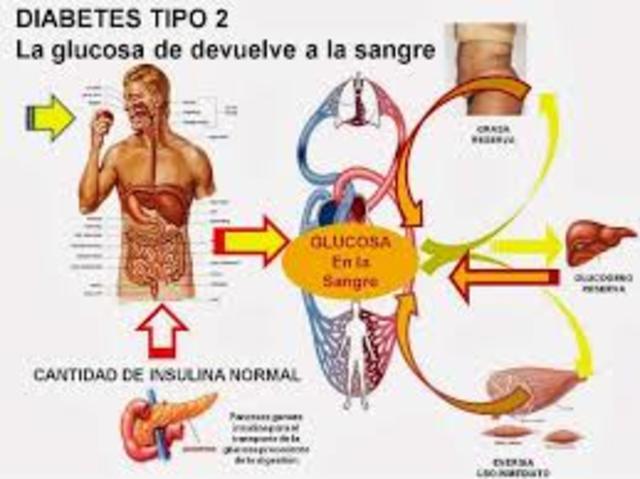DIABETES MELLITUS TIPO II