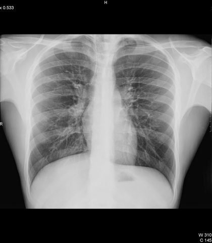 Telemetría, EGR y rX