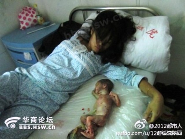 Abortos en china
