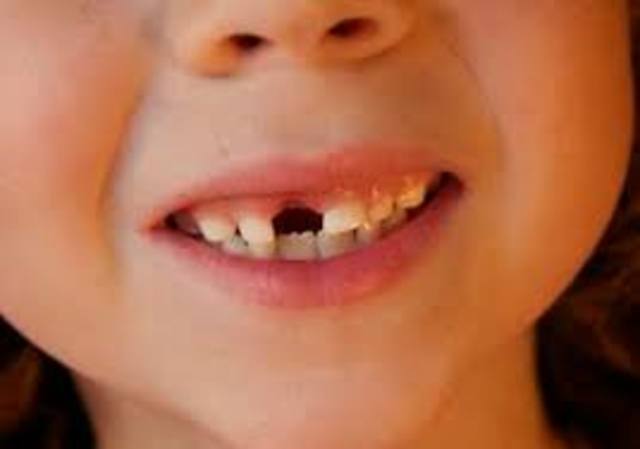 Se cae mi primer diente.