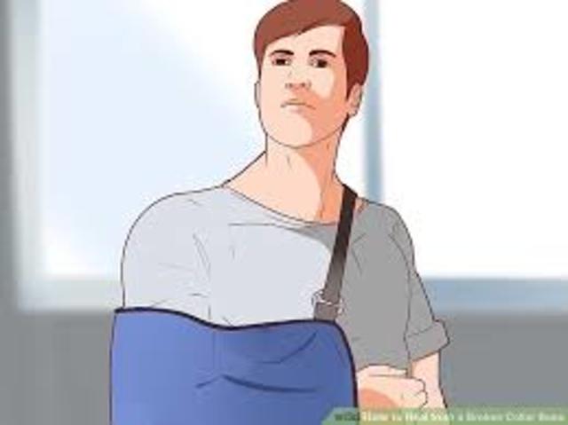 T.J. breaks his collarbone