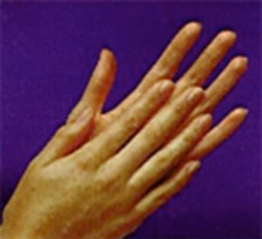 ARTE DE CUIDAR A LOS ENFERMOS