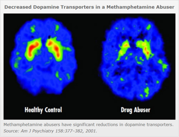 Current Day Drug Issues