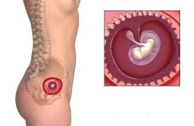 Trimester 1: Month 1