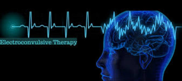 Electroconvulsive Therapy