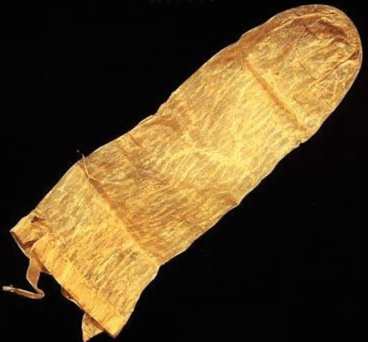 El Condón (Año 1640)