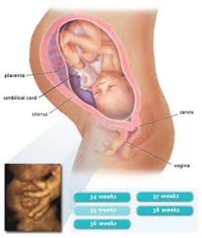 Trimester 3: Month 8