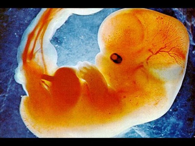 Month 1 -after conception