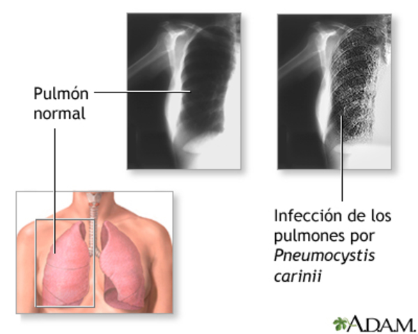 Informe Semanal De Mortalidad