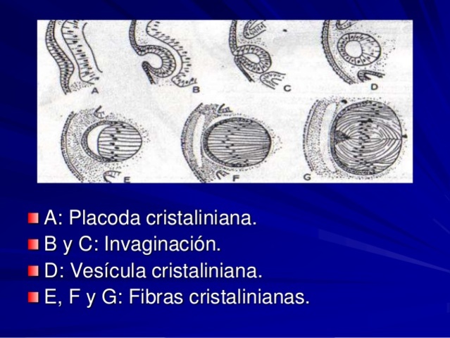 Fosetas y Vesículas cristalinianas