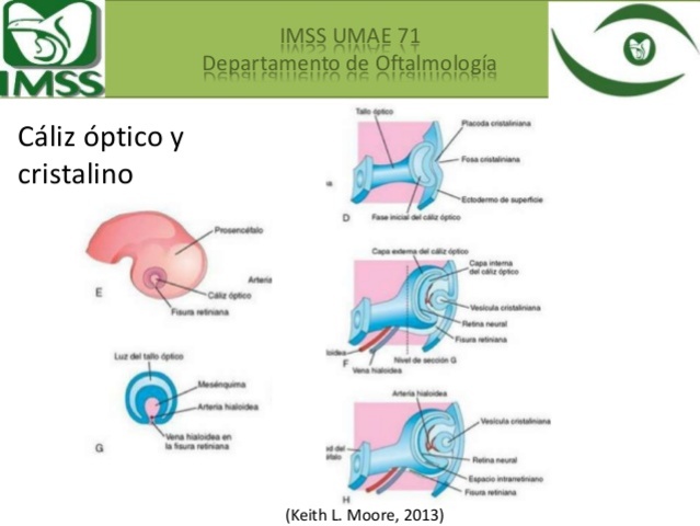 Calices opticos y Hendiduras retinianas