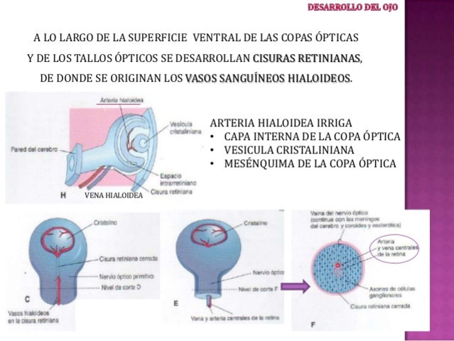 vasos sanguineos  hialoideos