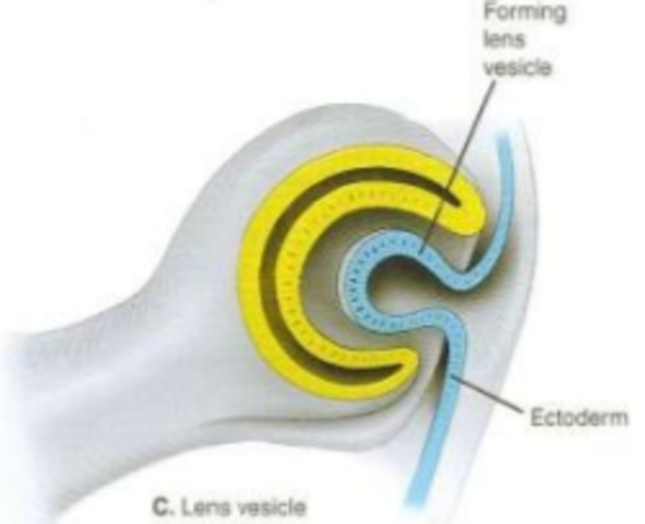 DESPRENDIMIENTO DE LA VESÍCULA DEL CRISTALINO.