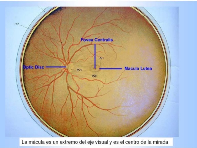 DEPRESIÓN MACULAR