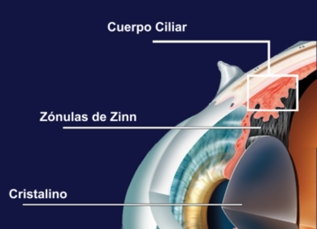 Cuerpo Ciliar e Iris