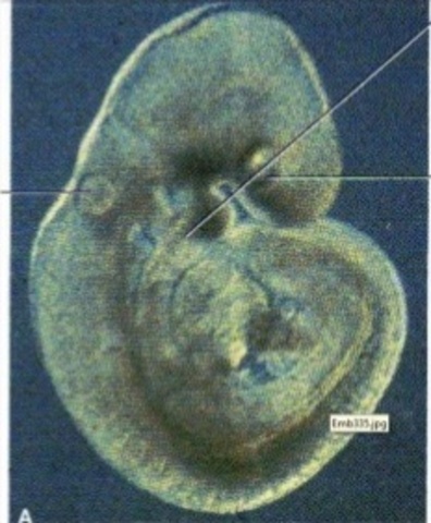 inicio del desarrollo del ojo