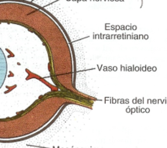ATROFIA DEL SISTEMA HIALOIDEO.